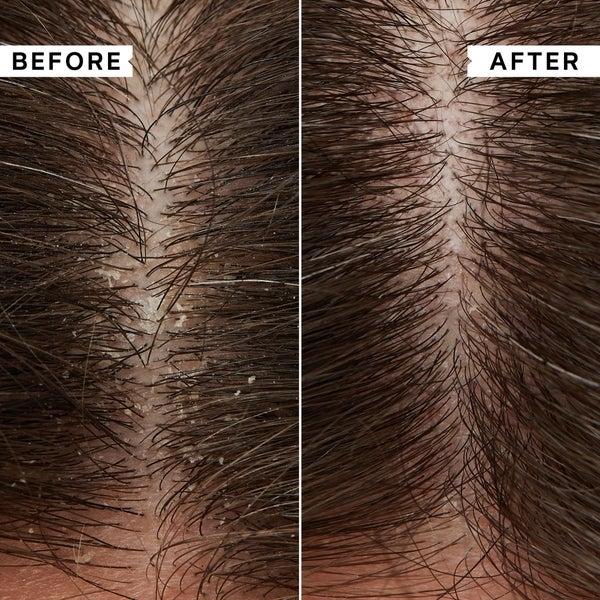 Philip Kingsley Philip Kingsley Flaky Itchy Scalp Shampoo 1000ml - (del valore di £ 88.00) Economico