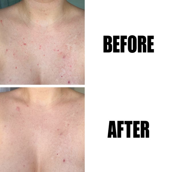 The INKEY List The INKEY List Glycolic Acid Exfoliating Body Stick 45g Super sconto