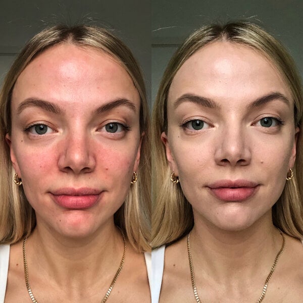 Dr.Jart+ Dr.Jart+ Cicapair Tiger Grass Color Correcting Treatment 15ml Vendita Economica