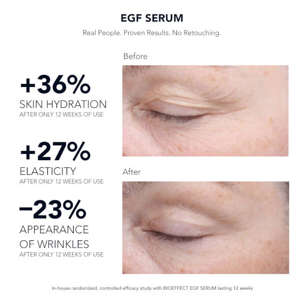 BIOEFFECT BIOEFFECT EGF Serum 15ml Sostegno trimestrale