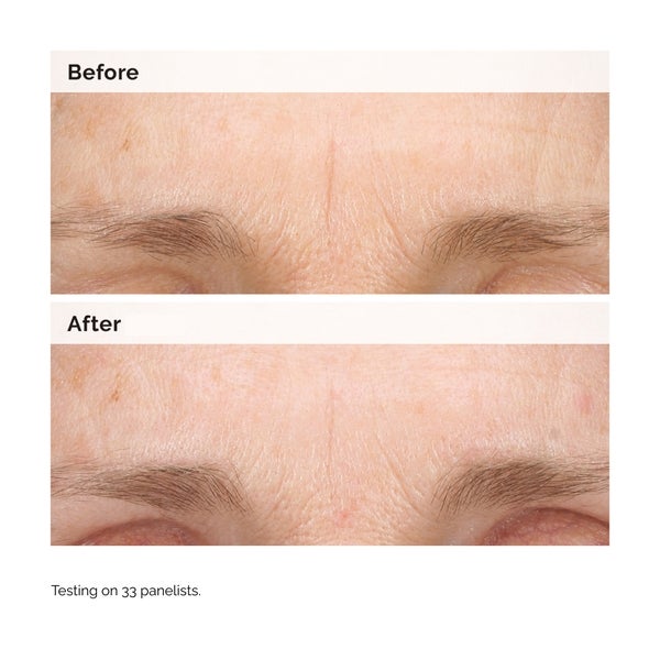 The Ordinary The Ordinary Retinal 0.2% Emulsion 15ml Online Outlet