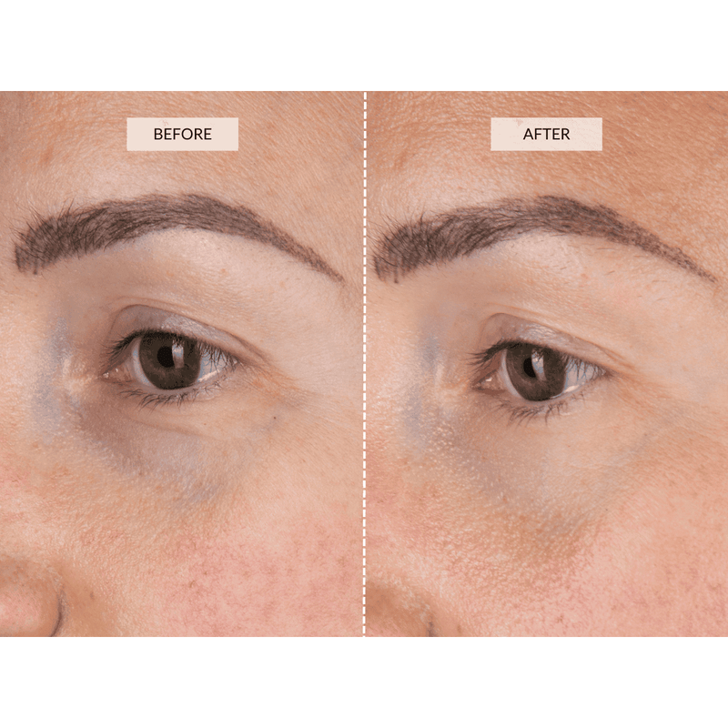 CurrentBody Skin LED Eye Perfector Moda
