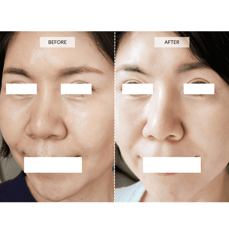 CurrentBody Skin Maschera viso LED 4-in-1 con mappatura a zone Currentbody Skin Qualità Garantita