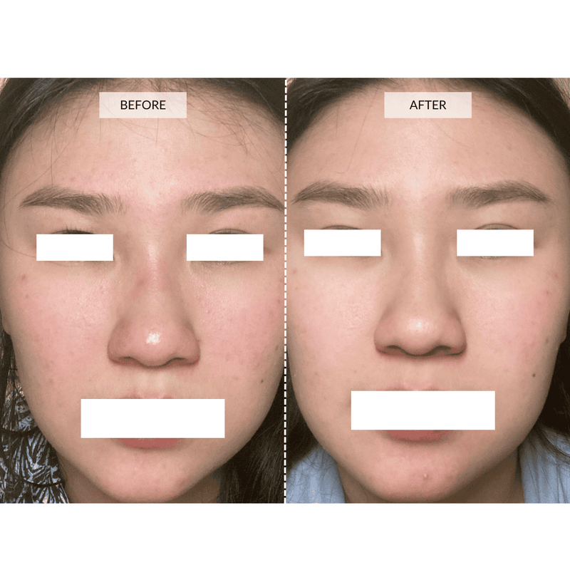 CurrentBody Skin Maschera viso LED 4-in-1 con mappatura a zone Currentbody Skin Qualità Garantita