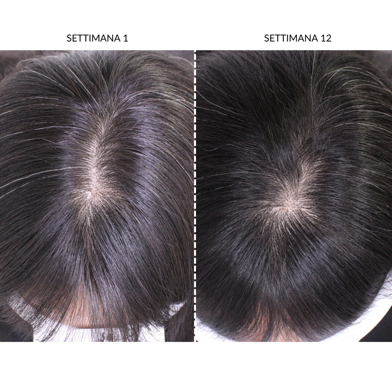 CurrentBody Skin Dispositivo LED Per la Ricrescita dei Capelli Acquista Ora