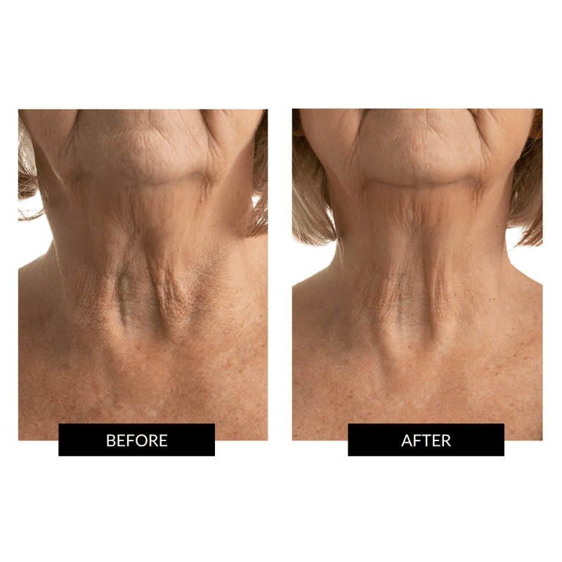 CurrentBody Skin Maschera Collo e Décolleté Promozione Limitata