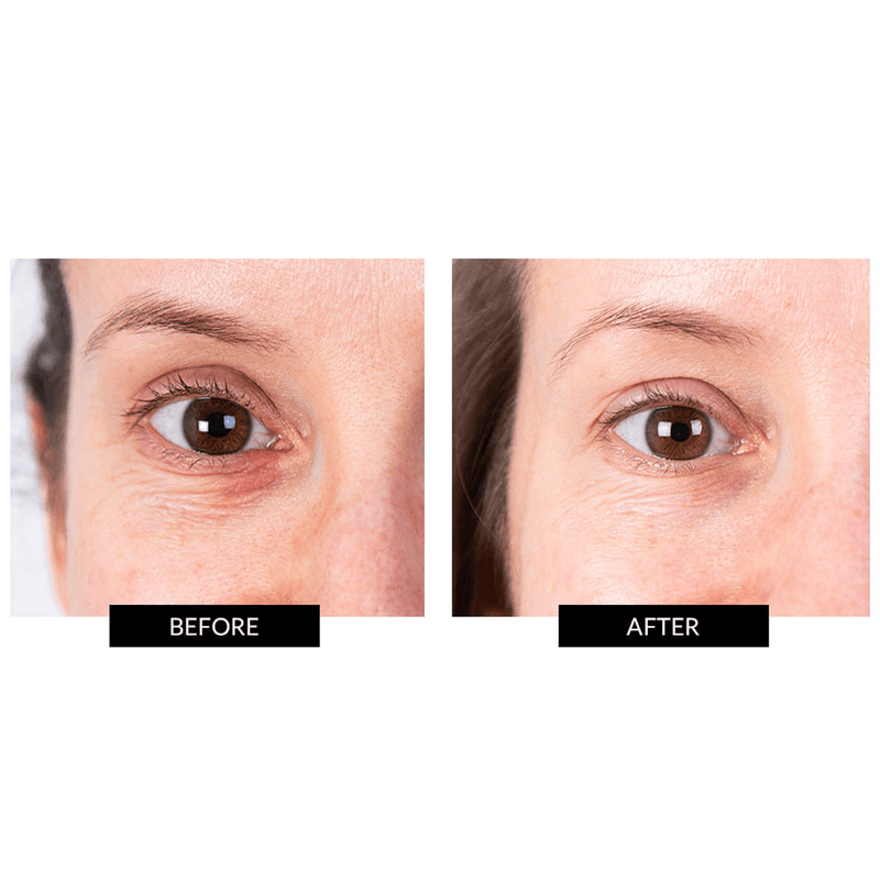 CurrentBody Skin LED Eye Perfector & 5 Eye Hydrogel Masks (del valore di 249€) Vendita Calda