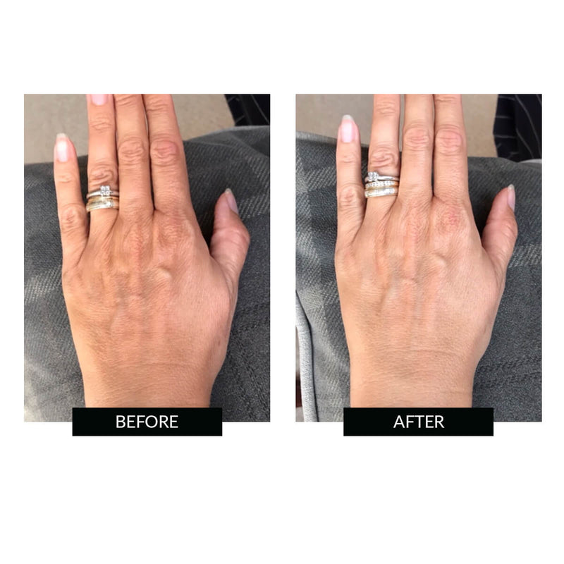 CurrentBody Skin Hand perfector LED Pezzi Unici