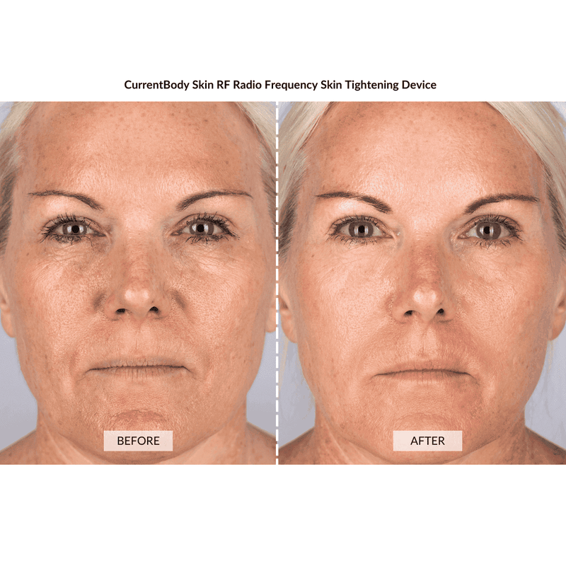 CurrentBody Skin Kit Viso Anti-età completo Nuovo