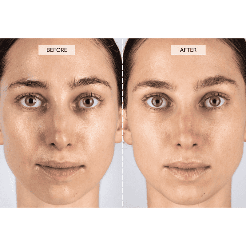 CurrentBody Skin Set Regalo Beauty LED In Vendita