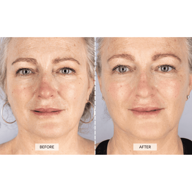 CurrentBody Skin Set Regalo Beauty LED In Vendita