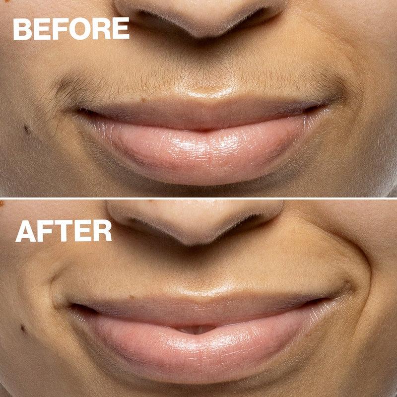 DERMAFLASH Dispositivo di Epilazione Mini Precision Peach Fuzz Vendite Flash