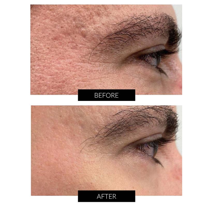 Dr Levy Set Stem Cell Miracle Trial (del valore di 495€) Fornitura limitata