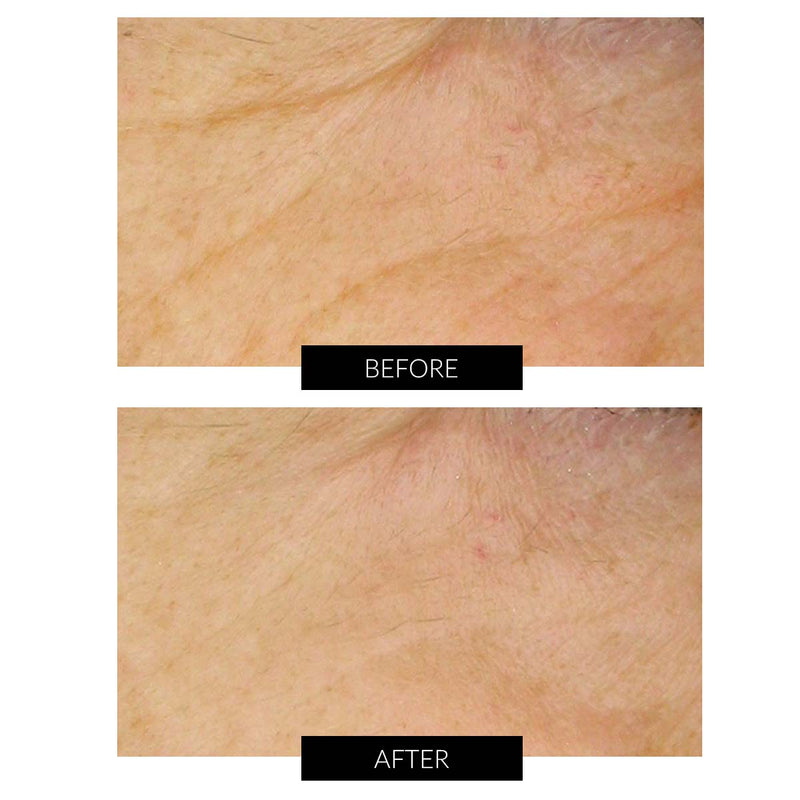 Dr Levy Set Stem Cell Miracle Trial (del valore di 495€) Fornitura limitata