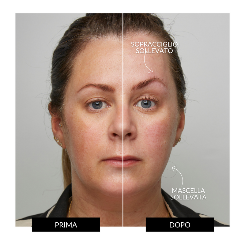 CurrentBody Skin Offers Dispositivo Tonificante Facciale ZIIP HALO Offerta Nuovi prodotti