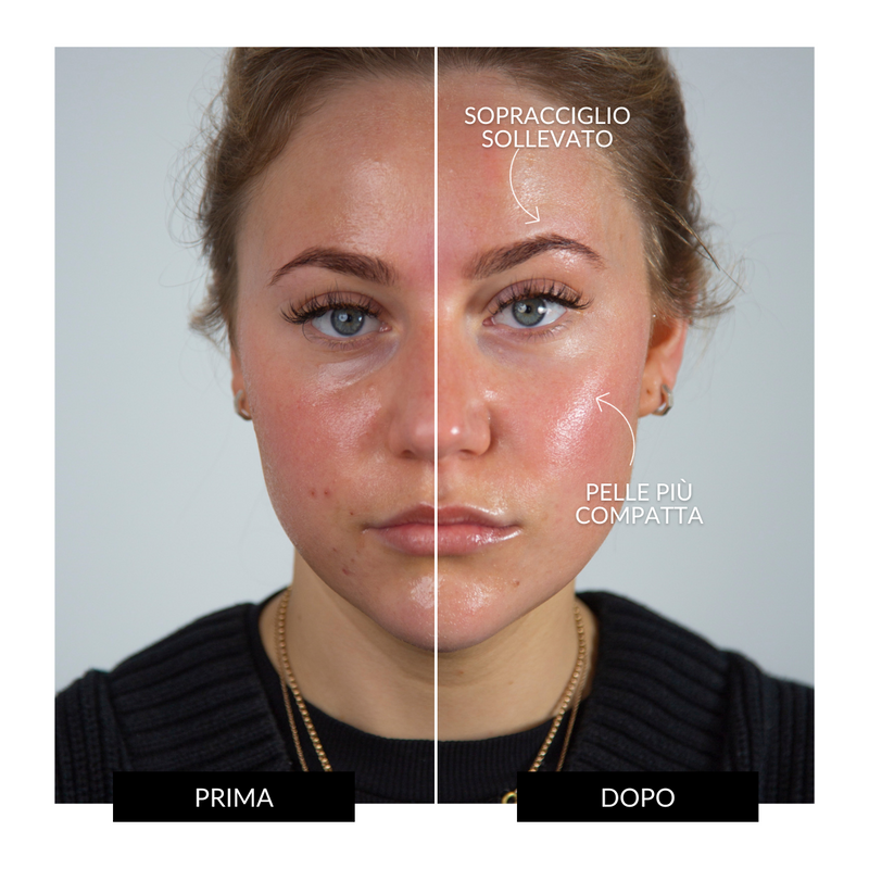 CurrentBody Skin Offers Dispositivo Tonificante Facciale ZIIP HALO Offerta Nuovi prodotti