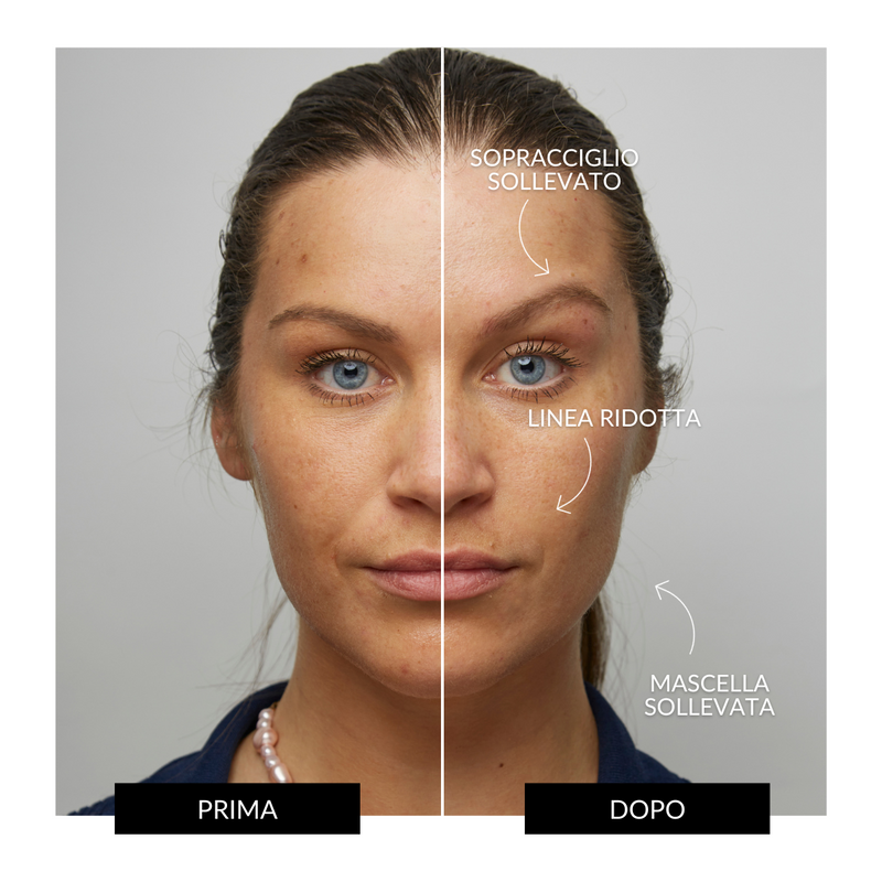 CurrentBody Skin Offers Dispositivo Tonificante Facciale ZIIP HALO Offerta Nuovi prodotti