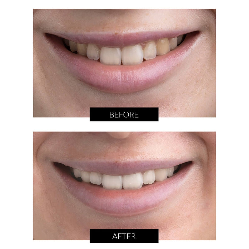 CurrentBody Skin Offers CurrentBody Skin Kit Sbiancamento Denti LED Offerta Economico