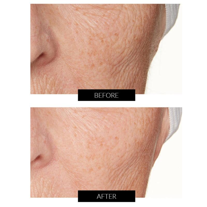 Lancer Skincare The Method: Nourish Normal-Combination Skin (50ml) Vendite Flash