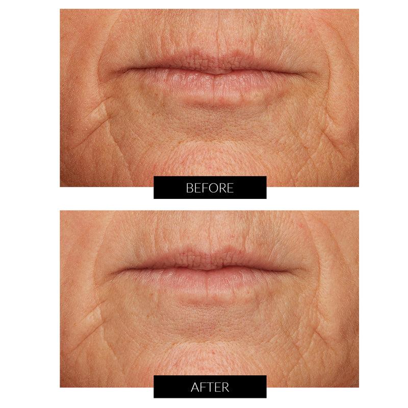 Lancer Acid Peel al Limone Caviale con Acido Glicolico (50ml) Vendita