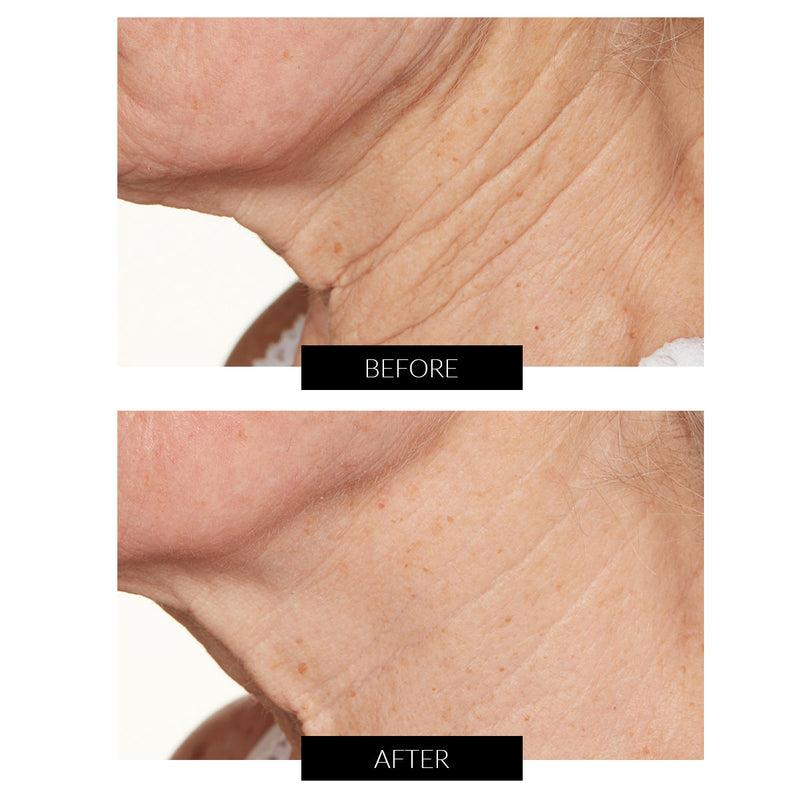 Lancer Skincare Trattamento Notte Intensivo con Hylaplex e Olio di Marula (50ml) Nuovo